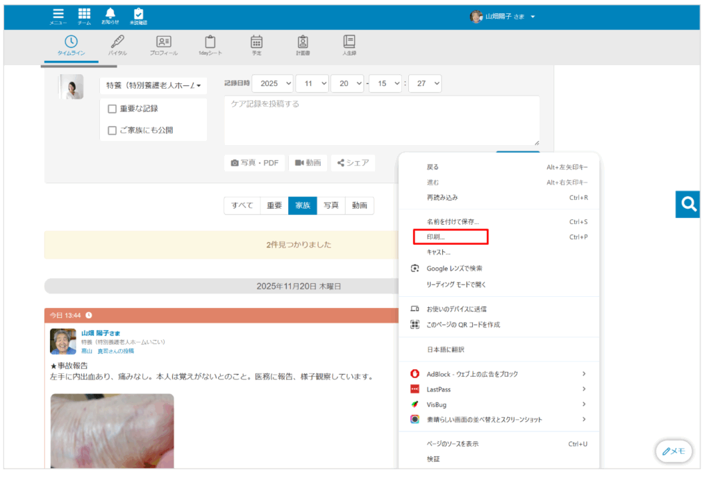 ケアコラボ タイムラインの印刷方法を説明する画面